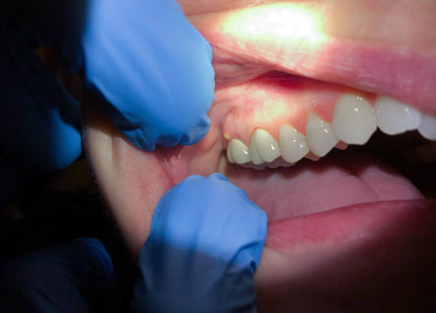 Best Emergency Orthodontic Repairs in Johnsonburg, PA