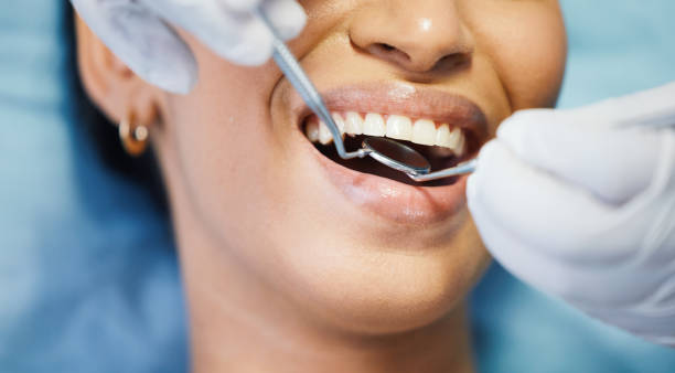 Best Emergency Wisdom Tooth Extraction in Johnsonburg, PA