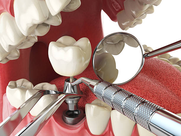 Best Emergency Orthodontic Repairs in Johnsonburg, PA